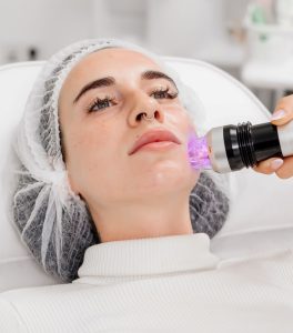 virtue rf microneedling scranton pa